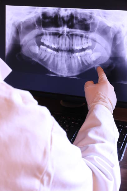Best Emergency Treatment for Dental Infections or Abscesses in South Euclid, OH