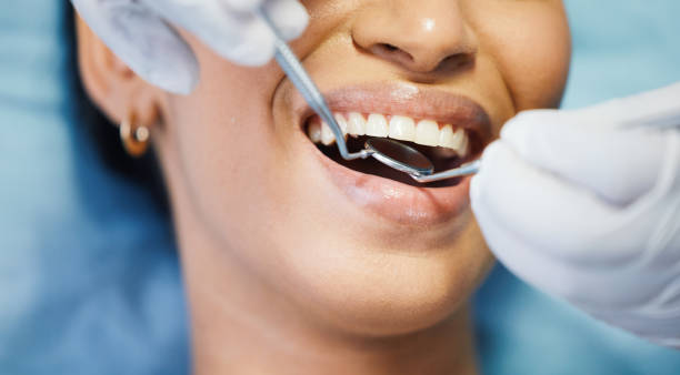 Best Same-Day Emergency Dental Services in South Euclid, OH